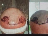 İZMİR'DE HASTALARIN CANI KİME EMANET ?